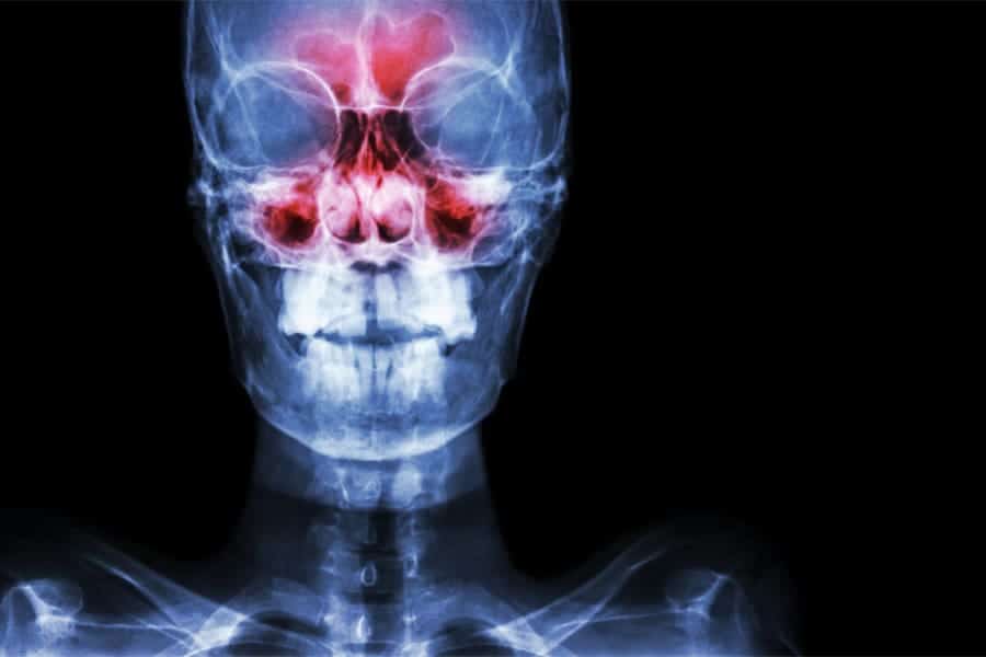 osteopathie cranienne osteopathie migraine osteopathie machoire cabinet osteopathie florent schoofs osteo paris 7 osteopathie 75007